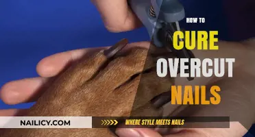 Fix Overcut Nails: Gentle Healing Tips for Quick Recovery
