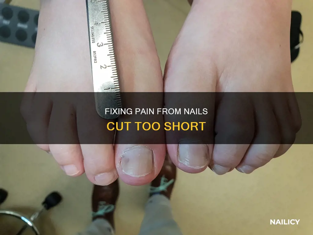 how to cure pain from cutting nails too short