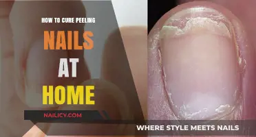 Effective Home Remedies to Repair and Strengthen Peeling Nails Fast
