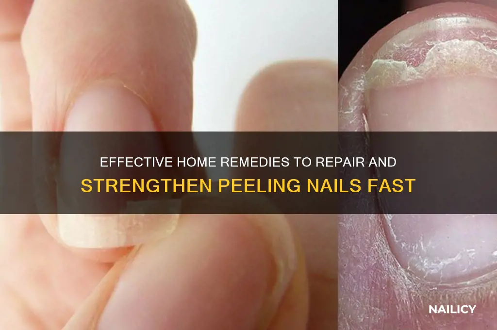 how to cure peeling nails at home
