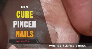 Effective Remedies for Treating and Preventing Pincer Nails at Home