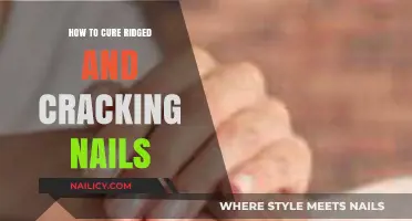 Restore Strong, Smooth Nails: Effective Remedies for Ridged and Cracking Nails