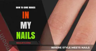 Smooth Out Nail Ridges: Effective Remedies for Healthy, Even Nails