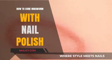 Unlikely Ringworm Remedy: Using Nail Polish for Quick Relief