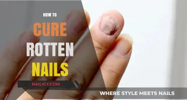 Effective Remedies to Heal and Restore Rotten Nails Naturally