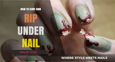 Heal Skin Rips Under Nails: Quick Remedies and Prevention Tips