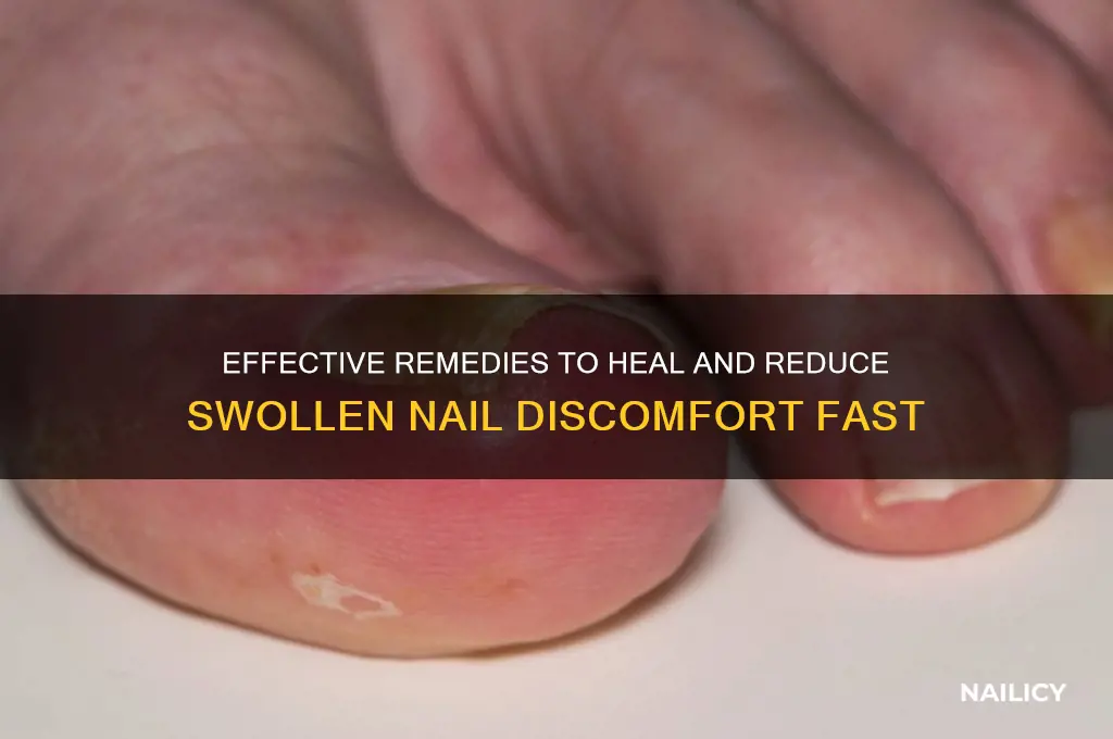 how to cure swollen nail