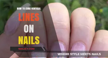Effective Remedies to Eliminate Vertical Lines on Your Nails
