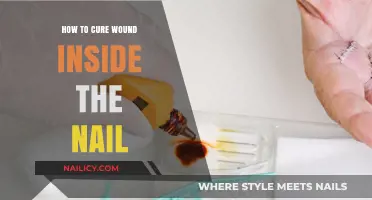 Effective Remedies to Heal Painful Wounds Underneath Your Fingernails