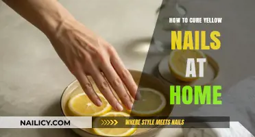 Effective Home Remedies to Restore and Brighten Yellow Nails Fast