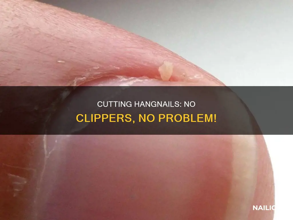 how to cut a hangnail without nail clippers