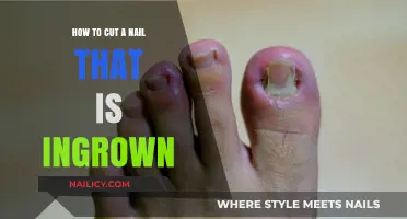Quickly Fix Ingrown Nails with These Easy Steps