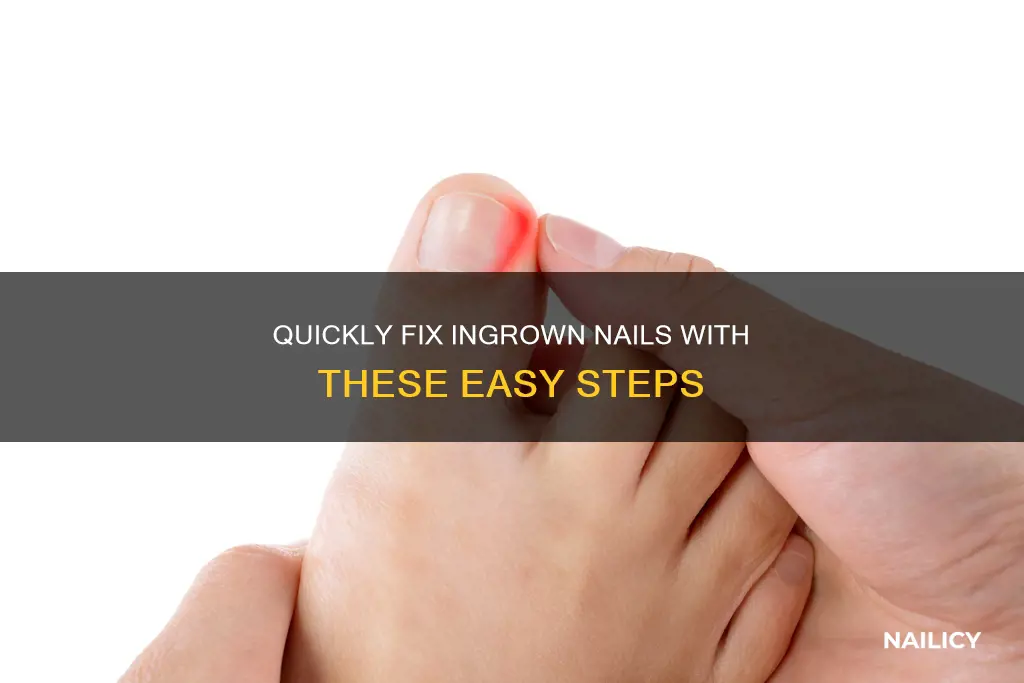 how to cut a nail that is ingrown