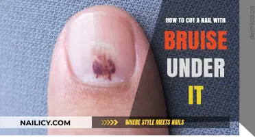 Treating Nail Bruises: Safe Clipping and Soothing Techniques