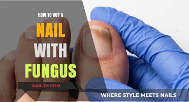Treating Nail Fungus: Cutting Nails the Right Way