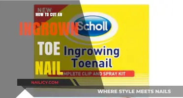 Expert Tips: Cutting Ingrown Toenails
