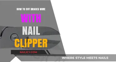 Cutting Braces Wire: Nail Clippers to the Rescue