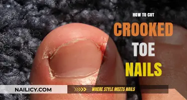 Trimming Crooked Toe Nails: The Right Way