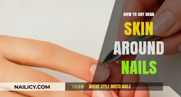 Get Rid of Dead Skin Around Nails