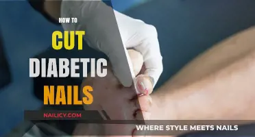 Trimming Diabetic Nails: A Safe and Healthy Guide