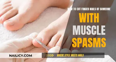 Caring Nail Cutting Guide for People with Muscle Spasms