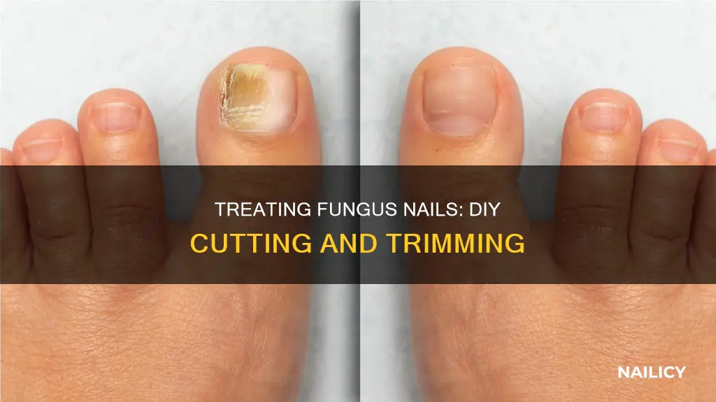 how to cut fungus nails