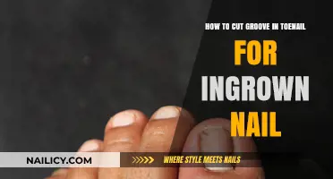 Trimming Ingrown Toenails: A Guide to Nail Groove Cutting