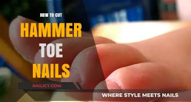 Trimming Hammer Toe Nails: A Step-by-Step Guide