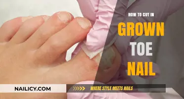 Cutting Ingrown Toenails: A Step-by-Step Guide