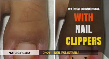 Clipping Ingrown Toenails: A Safe Guide