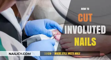 Involuted Nails: Trimming Tips and Tricks