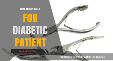 Caring for Diabetic Feet: Nail Cutting Tips