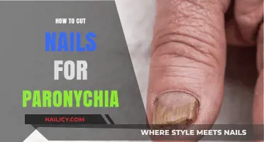 Cutting Nails with Paronychia: A Step-by-Step Guide