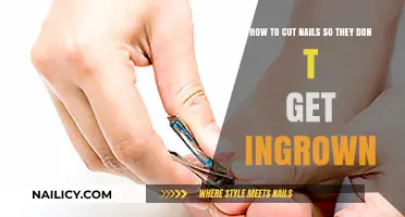 Prevent Ingrown Nails: A Step-by-Step Guide to Proper Nail Care