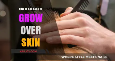 Cutting Nails the Right Way to Avoid Ingrown Toenails