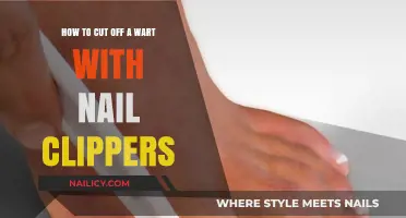 Trimming Warts With Nail Clippers: Safe or Not?