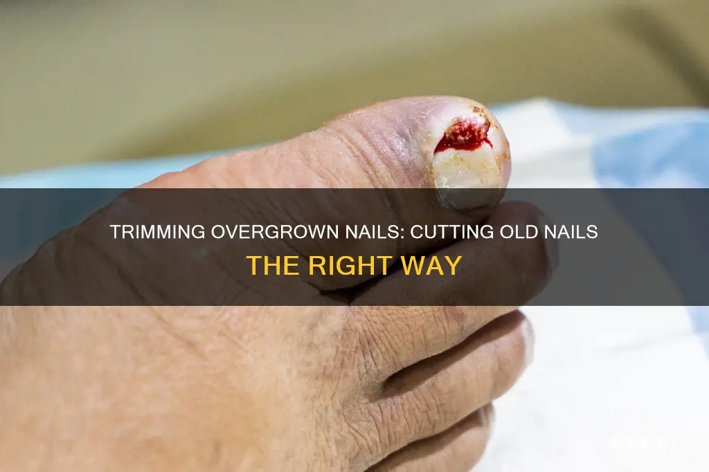 how to cut old nail that griws over new nail