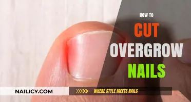 Trimming Overgrown Nails: A Simple Guide