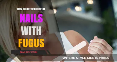 Treating Seniors' Toenail Fungus: Safe Trimming and Clipping