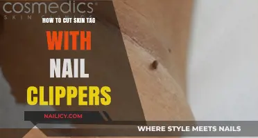 Trimming Skin Tags: Using Nail Clippers Safely