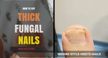 Trimming Thick Fungal Nails: Effective Home Remedies