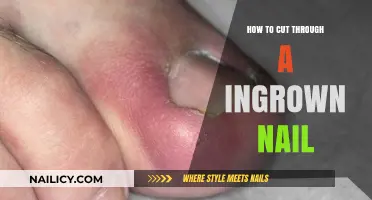 Expertly Clip an Ingrown Toenail at Home