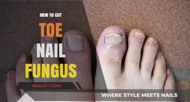 Eradicate Toenail Fungus: Cutting and Trimming