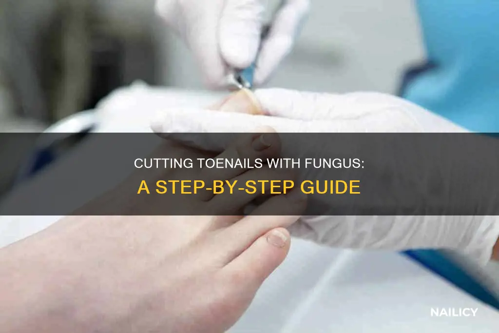 how to cut toe nails with f7ngus