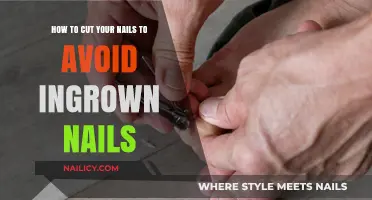 Cutting Nails Right: Avoiding Ingrown Nails