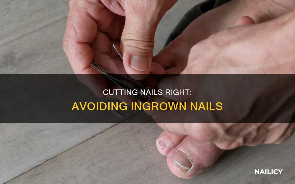 how to cut your nails to avoid ingrown nails