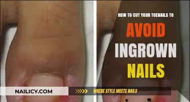 Trim Toenails: Prevent Painful Ingrown Nails