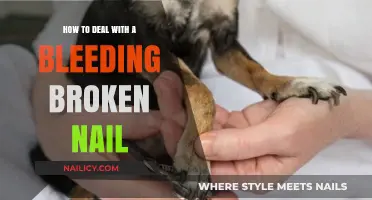 Quick Fix for a Bleeding Broken Nail: Simple and Effective Tips
