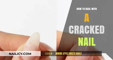 Quick Fixes for Cracked Nails: Repair and Strengthen Easily