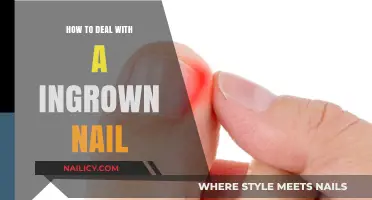 Effective Tips for Treating and Preventing Painful Ingrown Toenails